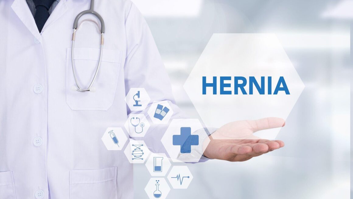 How Femoral (Thigh) Hernia Are Treated These Days